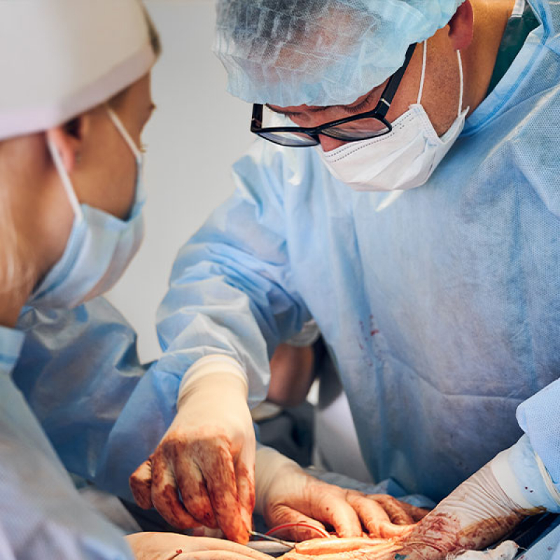 Cirurgia de Implante de Cateter Água Branca - Cirurgia Vascular Escleroterapia