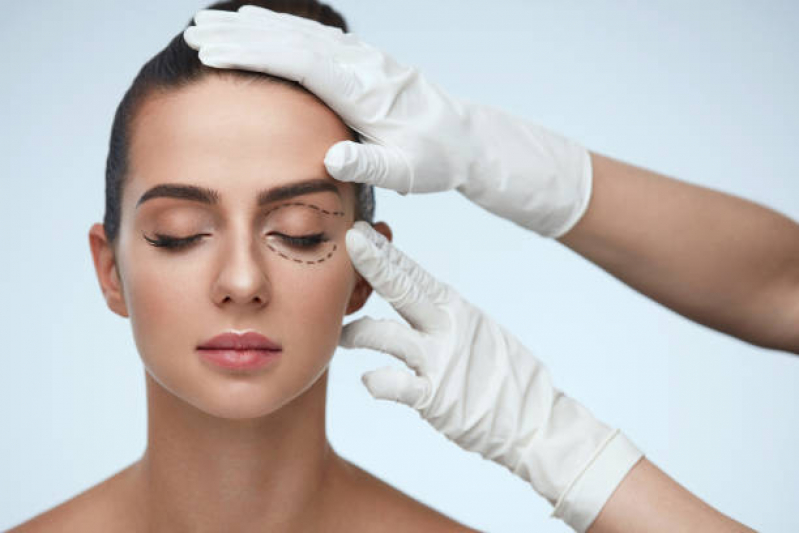 Cirurgia Plástica Facial Marcar Fradique Coutinho - Cirurgia Plástica no Rosto