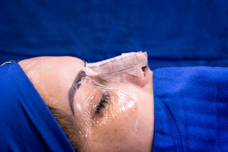 Cirurgia Rinoplastia Cirurgia Clínica Perus - Cirurgia Rinoplastia Fechada