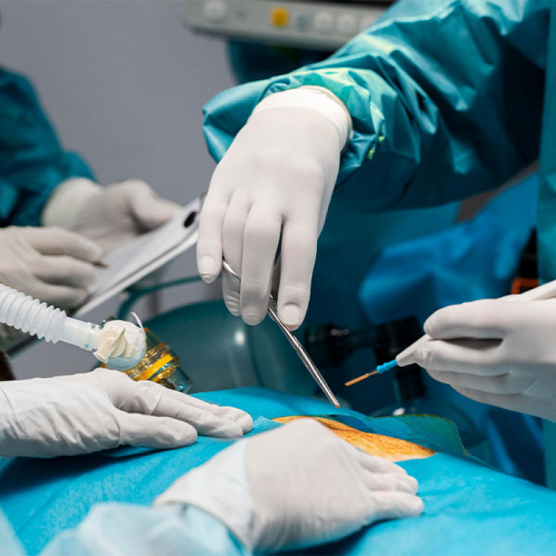 Cirurgia Videolaparoscopia Ginecológica Santana de Parnaíba - Cirurgia de Colocação de Diu