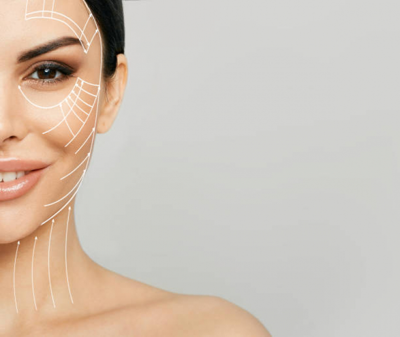Clínica de Lifting Facial sem Cirurgia Centro - Lifting para Testa