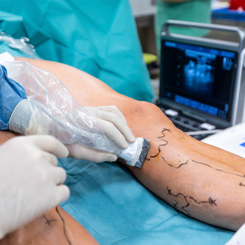 Clínica Que Faz Cirurgia Vascular Butantã - Cirurgia de Implante de Cateter