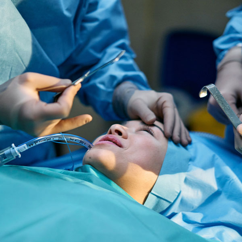 Onde Agendar Cirurgia de Blefaroplastia Barra Funda - Cirurgia de Implante Mamário
