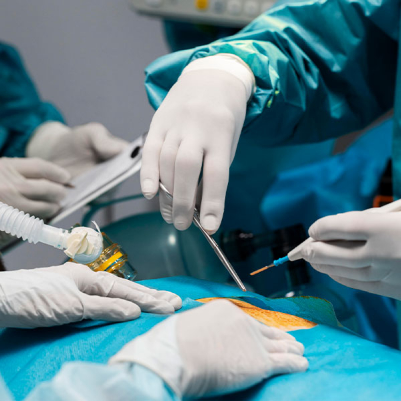 Onde Agendar Cirurgia de Colecistectomia Sumaré - Cirurgia de Hernioplastia Umbilical