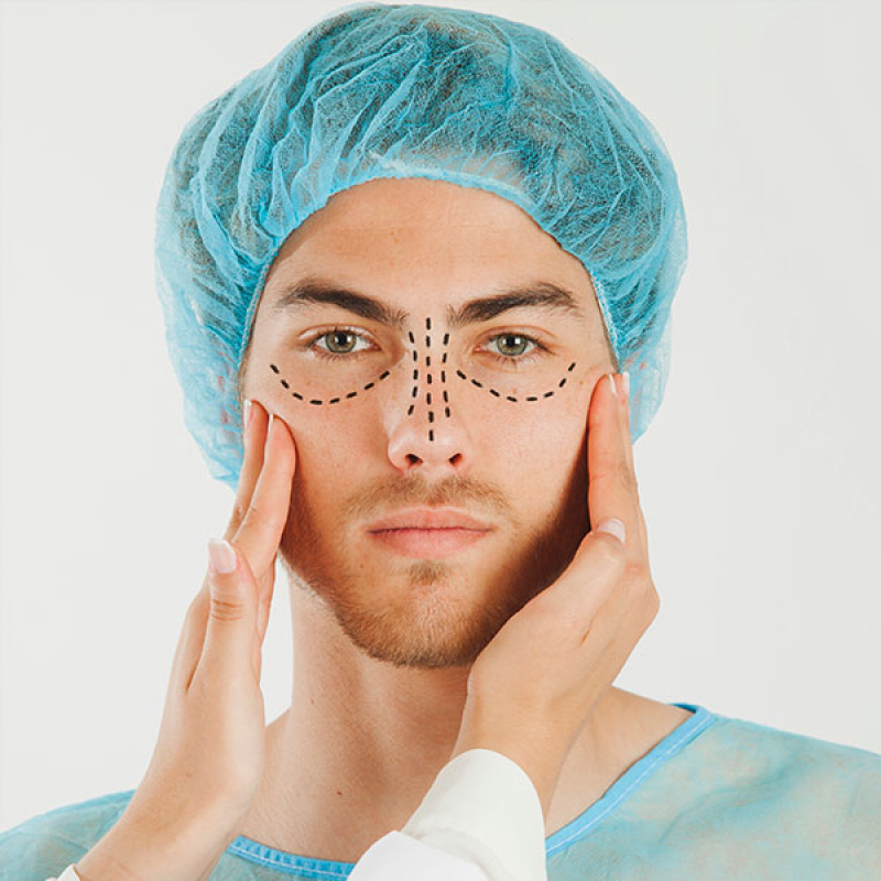 Onde Agendar Cirurgia de Lifting Facial Cerqueira César - Cirurgia Plástica