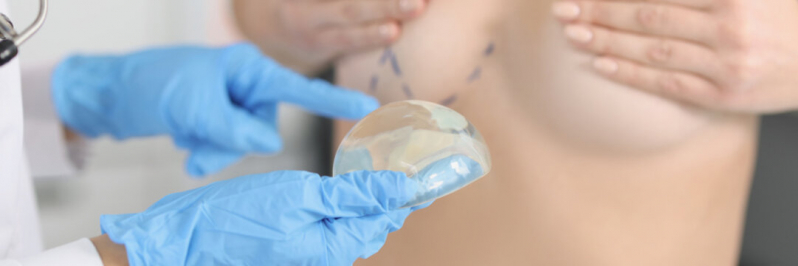 Onde Fazer Cirurgia de Mamoplastia de Aumento Mauá - Cirurgia de Prótese de Silicone