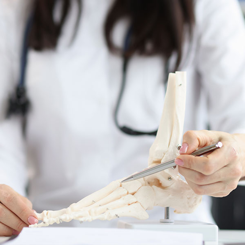 Onde Marcar Cirurgia de Osteotomia Mairiporã - Cirurgia Ortopédica para Tratamento da Dor