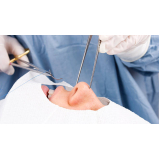 cirurgia desvio de septo e rinoplastia SCS