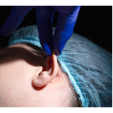 cirurgia orelha rasgada Vila Pompeia