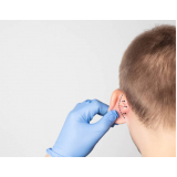 cirurgia para reduzir a orelha perto de mim ABC