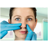clínica de cirurgia rinoplastia nariz de batata Chácara Inglesa