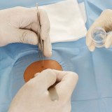 clínica que faz biópsia pré operatória Salesópolis