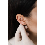 onde fazer cirurgia de redução de orelha Vila Romana